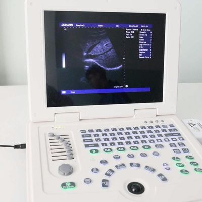 Qualität GYN Factory Supply Dw580 Portable Ultrasound Machine For Sale usine