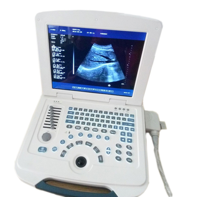 Einfache Stahloperations-mehrsprachige tragbare Ultraschall-Maschine